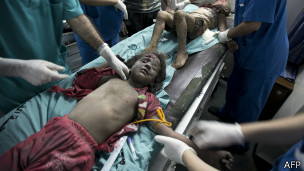 140712134804_gaza_wounded_child_304x171_afp